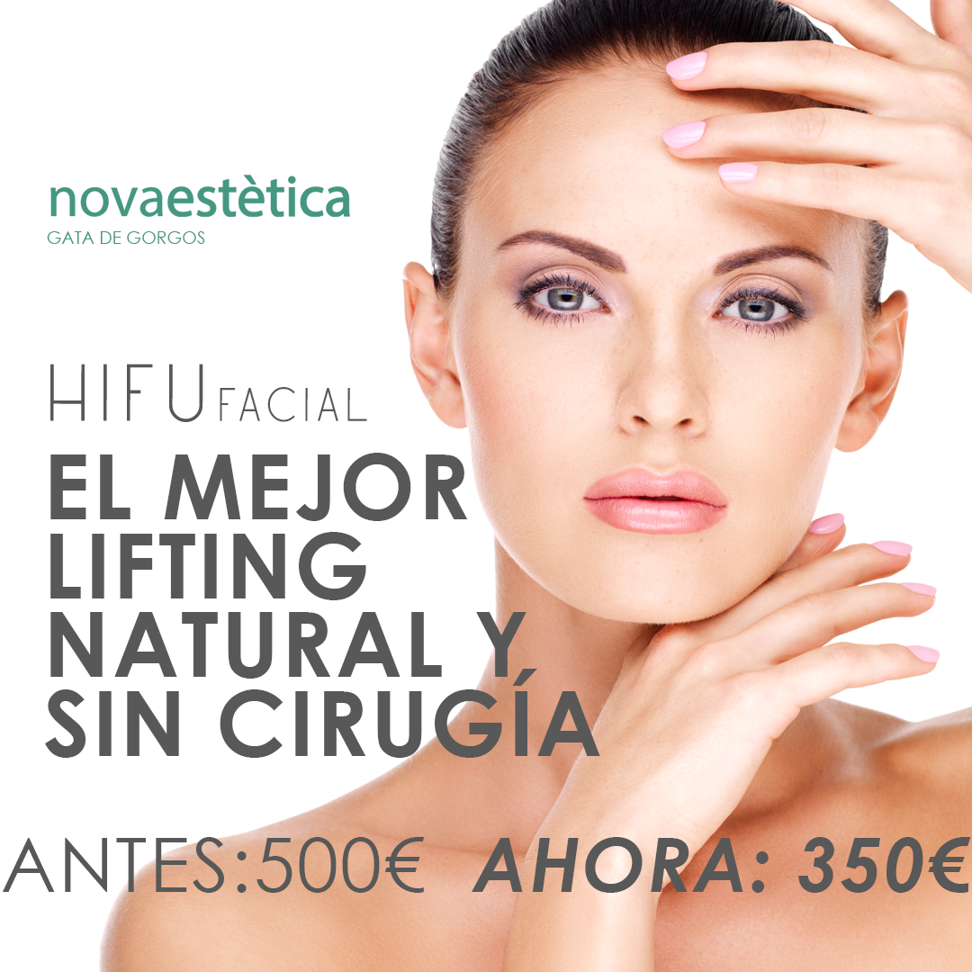 ¡Descubre HIFU el lifting natural de Novaestètica que está revolucionando el mundo de la estética!